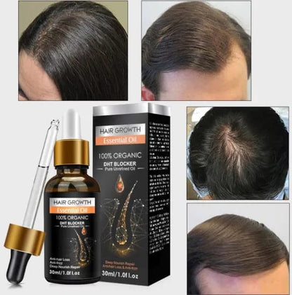 Ginger Hair Care Growth Serum